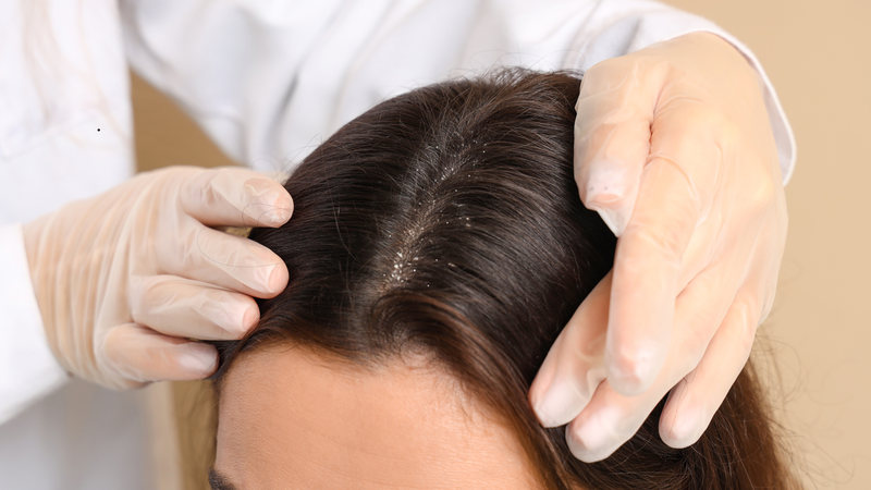 Lá trầu không giúp ức chế hoạt động của một số chủng nấm như nấm candida, hỗ trợ điều trị nấm da đầu nhẹ