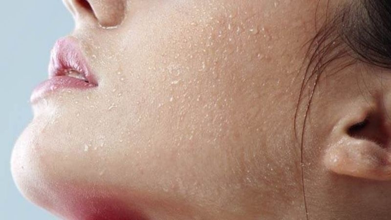 Gợi ý 3 loại treatment cho da khô an toàn và lành tính 1