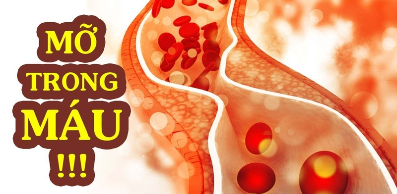 Gợi ý bữa sáng cho người mỡ máu cao cải thiện sức khỏe 1