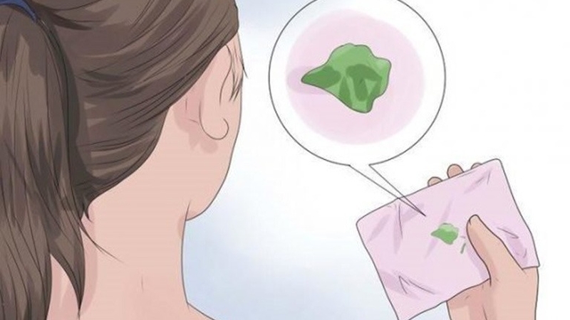 Gợi ý chị em cách chữa khí hư màu xanh tại nhà 1