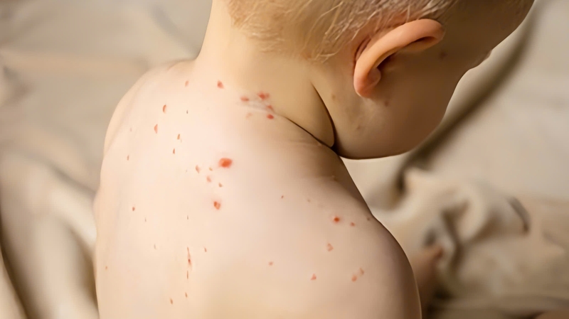 goi-y-dia-chi-kham-thuy-dau-cho-tre-uy-tin-tai-ha-noi-va-tp-ho-chi-minh 2