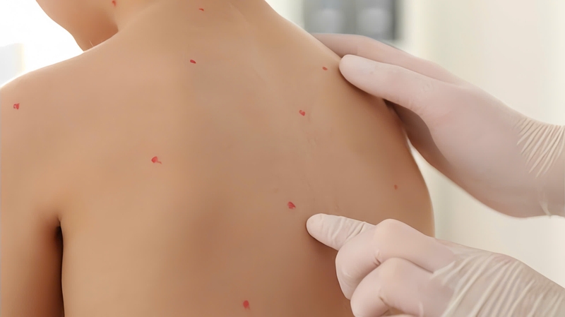 goi-y-dia-chi-kham-thuy-dau-cho-tre-uy-tin-tai-ha-noi-va-tp-ho-chi-minh 4