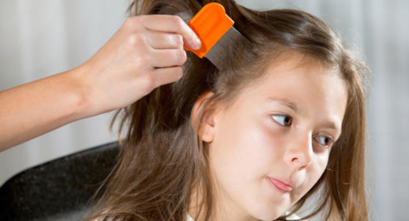 Gợi ý những cách trị chấy cho người lớn hiệu quả cao 3