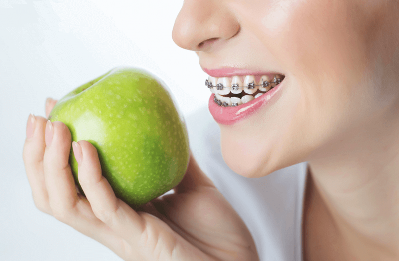 Gợi ý thực đơn cho người niềng răng vừa đảm bảo sức khoẻ 2