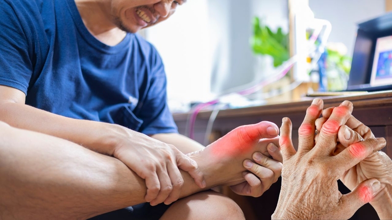 Gout cấp tính là gì? Những vấn đề cần biết về gout cấp tính 5
