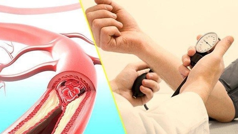 Huyết áp là gì? Tầm quan trọng của chỉ số huyết áp đối với sức khỏe 1