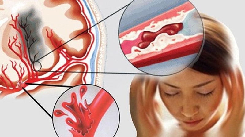 Huyết áp là gì? Tầm quan trọng của chỉ số huyết áp đối với sức khỏe 2