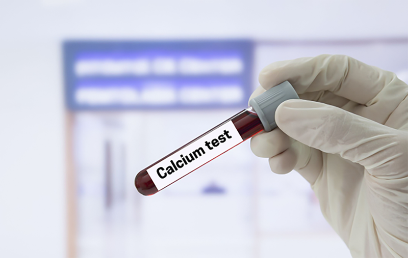 Hạ canxi máu: Tham khảo phác đồ điều trị hạ canxi máu bộ y tế  2