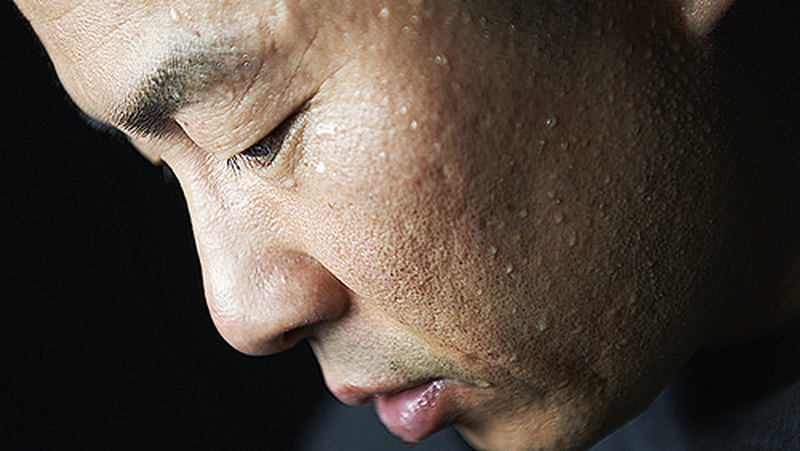 Hạ đường huyết vã mồ hôi và cách xử lý1