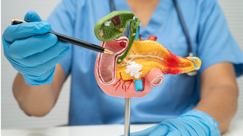 Phân loại tổn thương tuyến tụy giúp định hướng điều trị cường insulin bẩm sinh