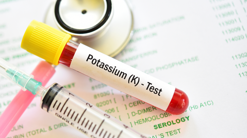 Hạ kali máu nặng có thể gây rối loạn nhịp tim hoặc thậm chí là tử vong