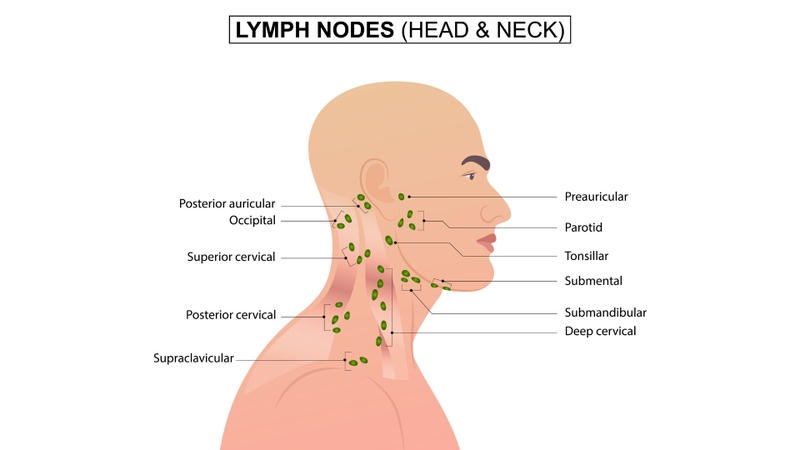 Hạch bạch huyết vùng đầu - cổ là nhóm hạch dễ sờ thấy khi có viêm nhiễm vùng tai, mũi, họng hoặc răng miệng