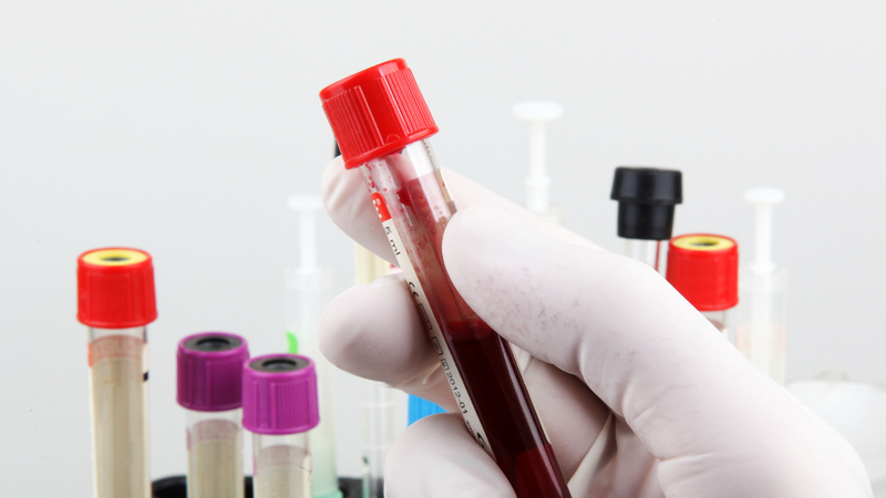 hach-co-ron-co-nguy-hiem-khong-hieu-biet-ve-hach-co-ron 3