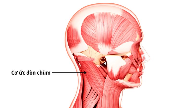hach-co-uc-don-chum-co-nguy-hiem-khong-nguyen-nhan-xuat-hien-hach-co-uc-don-chum 1