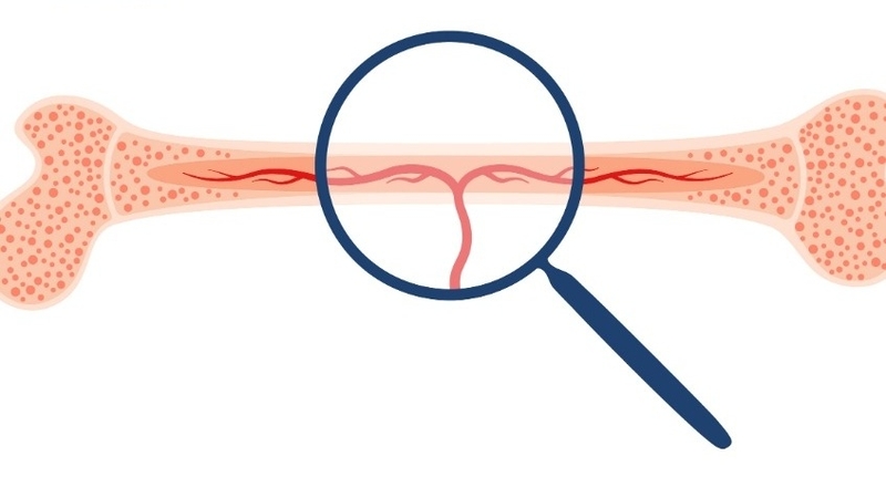 Hạch là gì? Các vị trí thường bị nổi hạch 3