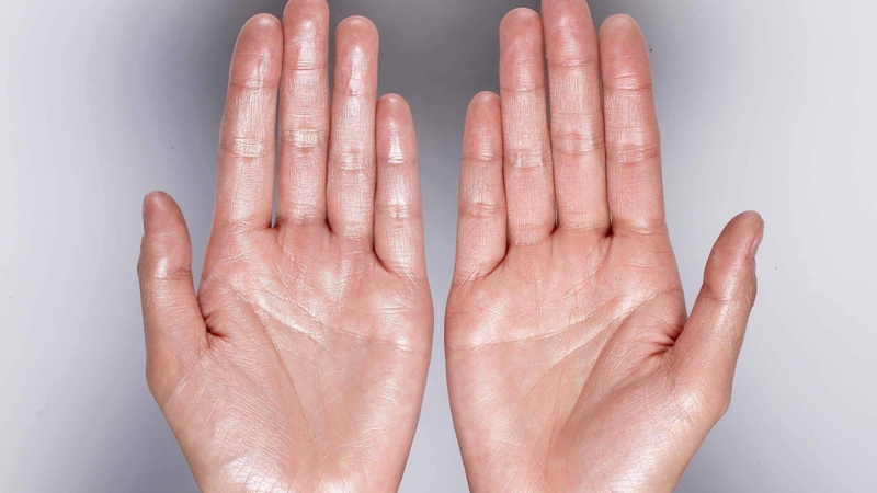 Hạch thần kinh giao cảm và mối liên hệ của triệu chứng đổ mồ cơ thể 2