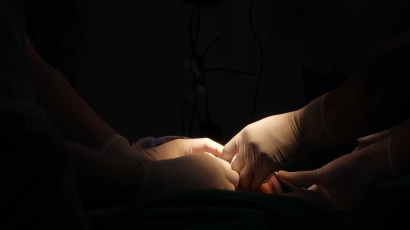 Thành công này đánh dấu bước tiến quan trọng của chuyên ngành phẫu thuật sọ mặt tại Việt Nam