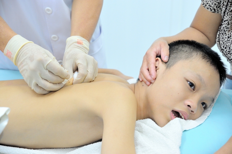 Châm cứu cho trẻ tự kỷ và những lưu ý cần thiết 3