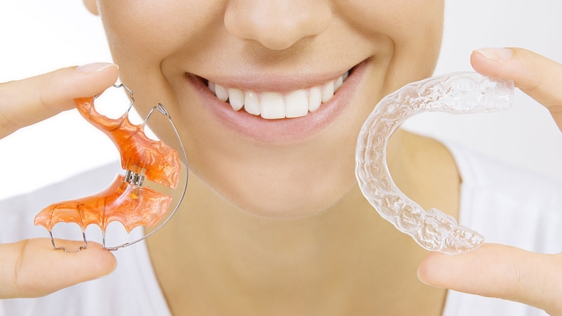 Vệ sinh hàm duy trì Vivera khá đơn giản