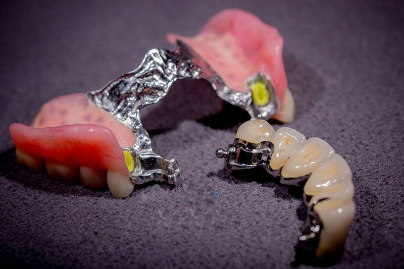 Hàm khung liên kết là gì? Hàm khung liên kết chia thành mấy loại? 2