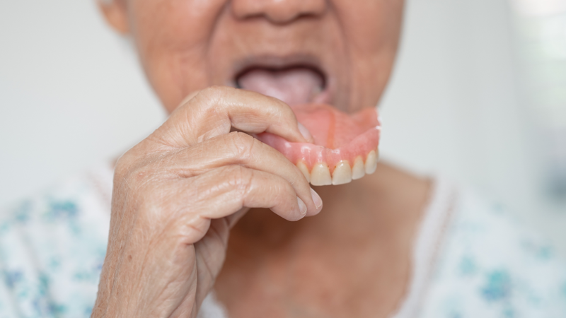 Viêm niêm mạc miệng do hàm giả có thể diễn tiến âm thầm, khó nhận ra