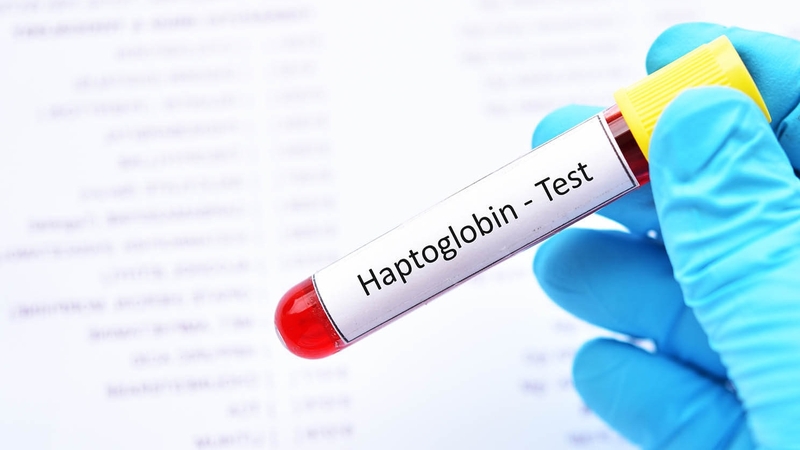 “Haptoglobin là gì?” chắc hẳn là câu hỏi mà nhiều người thắc mắc hiện nay