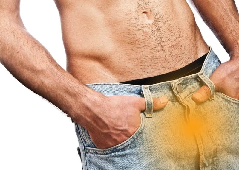 Triệu chứng chuỗi hạt ngọc dương vật