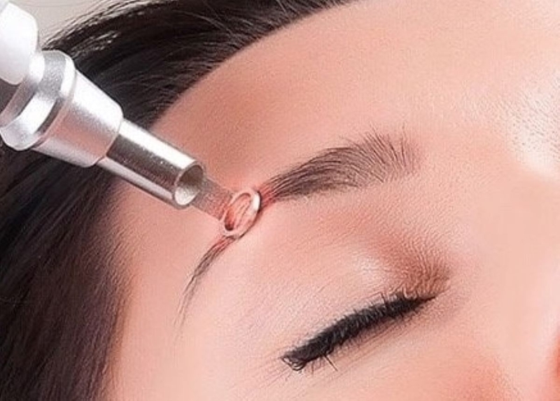 Hậu quả điêu khắc lông mày kém chất lượng và cách khắc phục