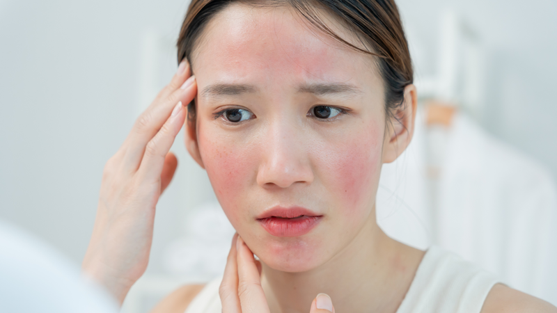 Khi có biểu hiện kích ứng, cần tạm ngưng sử dụng Tretinoin