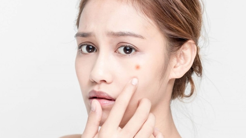 Hậu quả tiêm filler và những lưu ý an toàn chị em nên biết trước khi tiêm filler 4