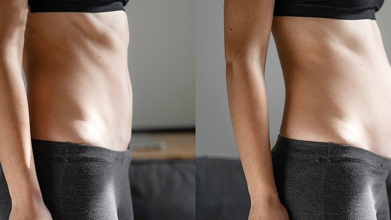 Bệnh bạch cầu tế bào tóc là gì? 2