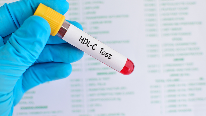 HDL cholesterol là gì và những cảnh báo sức khoẻ khi chỉ số HDL cholesterol giảm 3