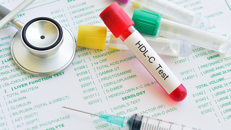 HDL cholesterol là gì và những cảnh báo sức khoẻ khi chỉ số HDL cholesterol giảm 5