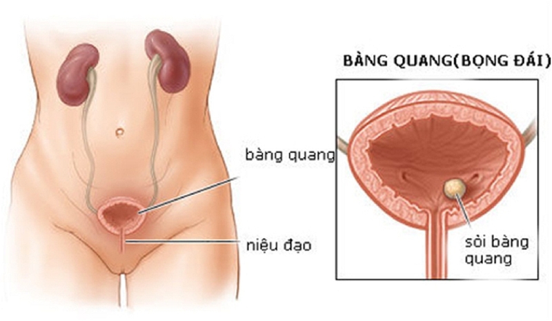 bàng quang đóng vai trò chưa nước tiểu