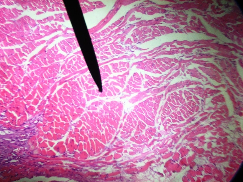 Hệ cơ: Cấu tạo, chức năng và cơ chế hoạt động 2