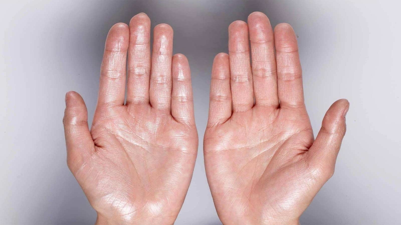 Hệ lụy của rối loạn thần kinh thực vật là gì? 3