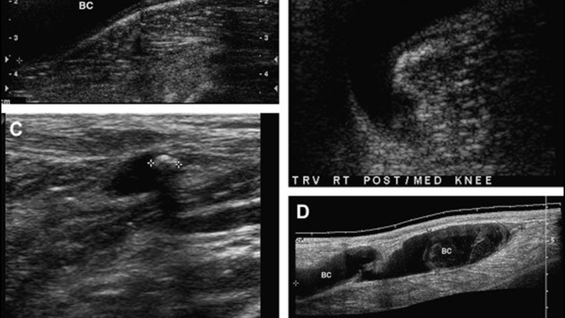 Hệ thống tĩnh mạch chi trên của cơ thể gồm những gì? 1