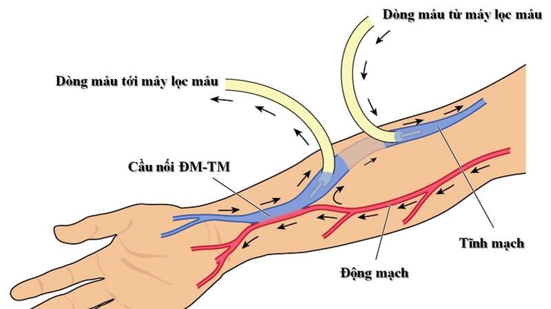 Hệ thống tĩnh mạch chi trên của cơ thể gồm những gì? 3
