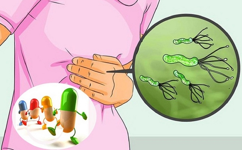 Helicobacter pylori Ag test nhanh là gì? Các phương pháp xét nghiệm phổ biến nhất 3