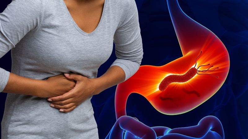 Helicobacter pylori Ag test nhanh là gì? Các phương pháp xét nghiệm phổ biến nhất 4