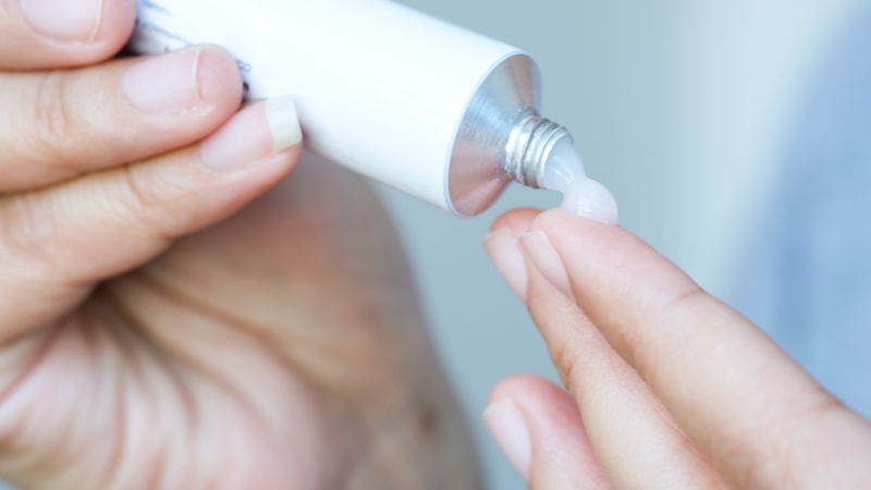 Sử dụng kem bôi steroid tại chỗ