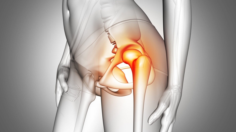 Hẹp khớp háng là do đâu? Cách khắc phục như thế nào? 1