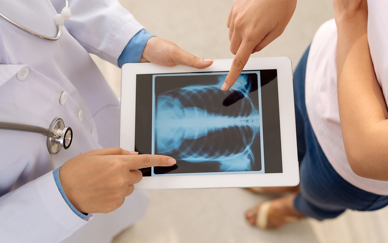 Hết sức cẩn thận khi ho ra đờm có máu  3