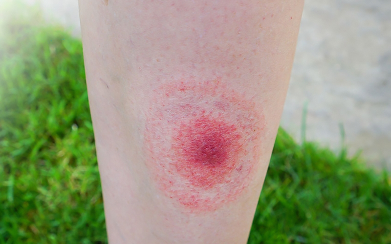 Hiện nay xét nghiệm ký sinh trùng bao nhiêu tiền? 2