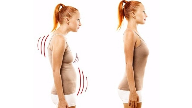 Hiện tượng cột sống bị tổn thương: Lưng tôm 1