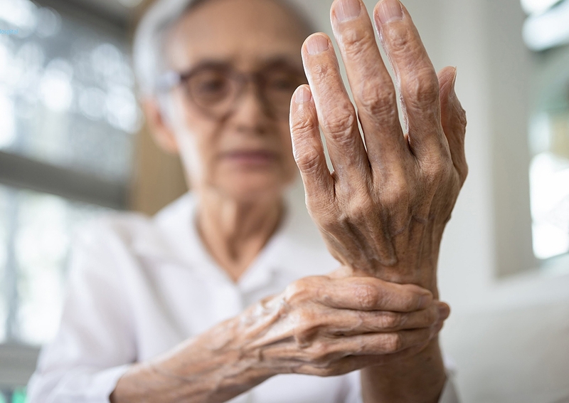 Hiện tượng đau khớp tay là gì? Nguyên nhân và cách khắc phục 2