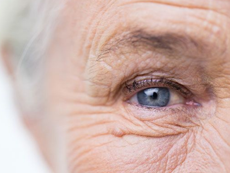 Hiện tượng mắt nhìn thấy đốm sáng là gì?