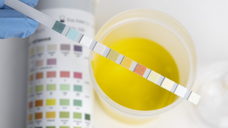 Hiện tượng nước tiểu màu xanh sau khi uống thuốc có nguy hiểm không? 5