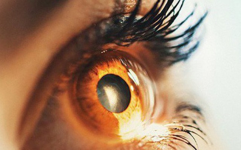 Hiểu đúng thoái hóa điểm vàng ở người trẻ