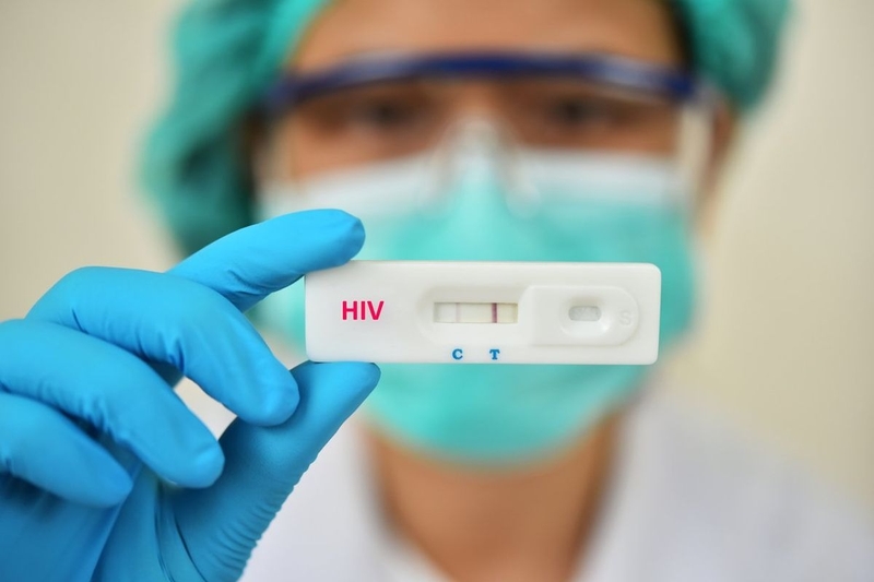 Hiểu rõ các phương pháp xét nghiệm HIV: Kiến thức quan trọng về sức khỏe cần nắm! 2
